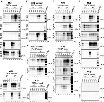 PMCA-Based Detection of Prions in the Olfactory Mucosa of Patients With Sporadic Creutzfeldt–Jakob Disease